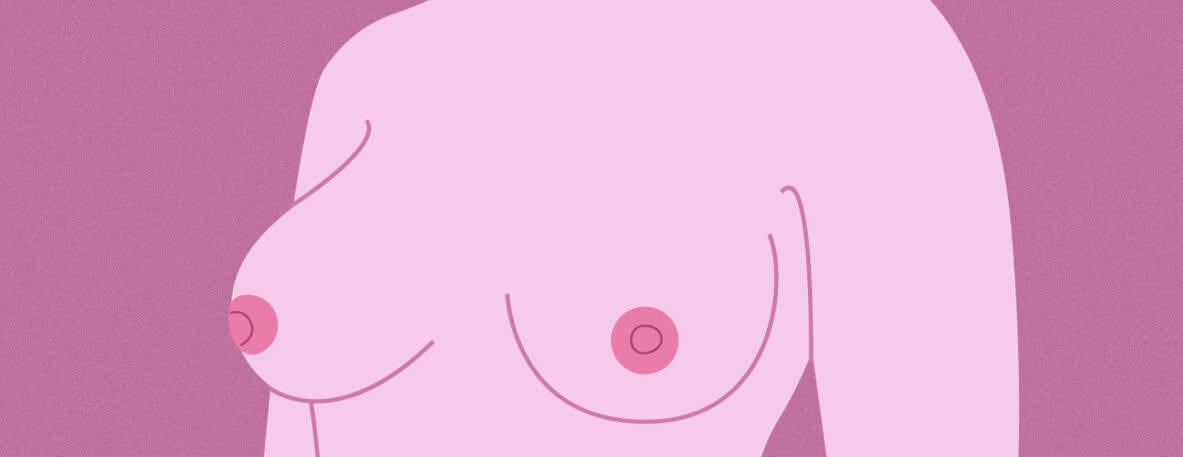 Die Ebenen - Flachwarzen