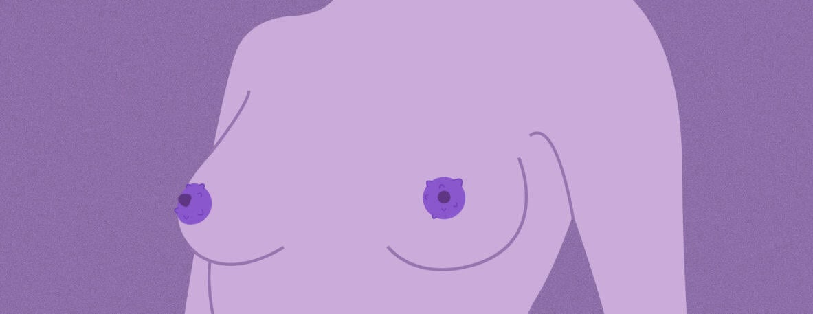 Die Unebenen - Brustwarzen mit Hügelchen