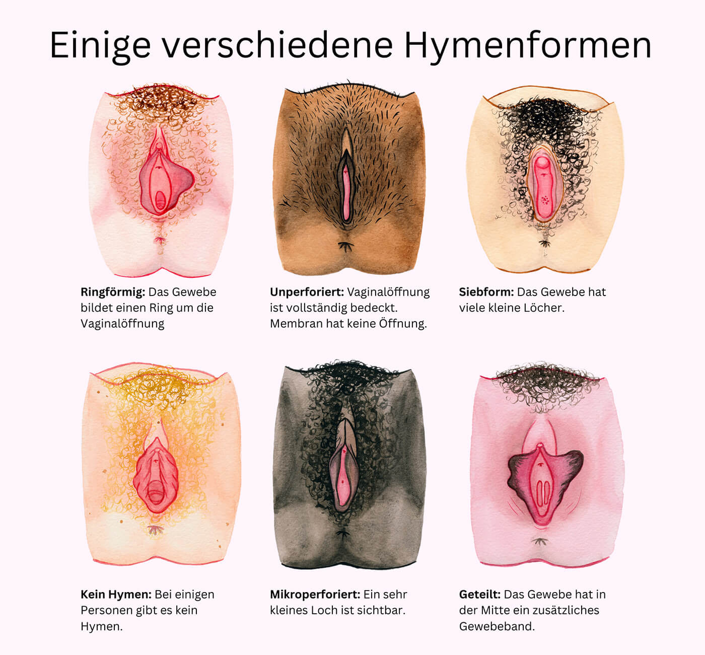 Verschiedene-Hymenformen-Illustration Verschiedene-Hymenformen-Illustration
